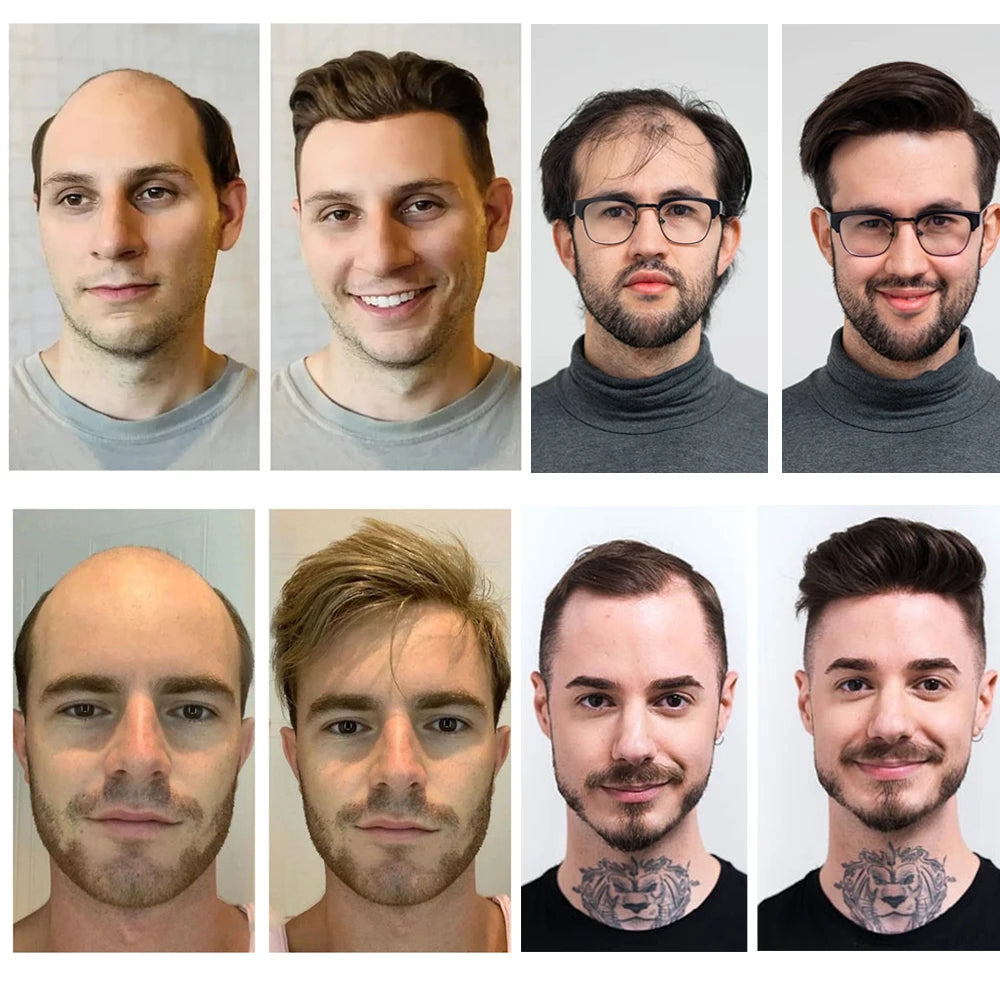 Herren-Haartoupet mit unsichtbarem Swiss Lace Front & Skin-Basis

Hochwertiges Haarsystem mit gebleichtem Haaransatz, Swiss Lace Front und Skin-Basis – für einen nahtlosen, natürlichen Hollywood-Look.
100 % Echthaar, id